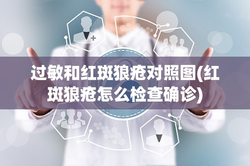 过敏和红斑狼疮对照图(红斑狼疮怎么检查确诊)