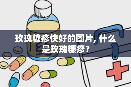 玫瑰糠疹快好的图片, 什么是玫瑰糠疹？