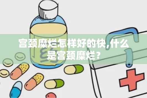 宫颈糜烂怎样好的快,什么是宫颈糜烂？