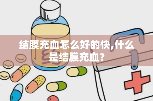 结膜充血怎么好的快,什么是结膜充血？